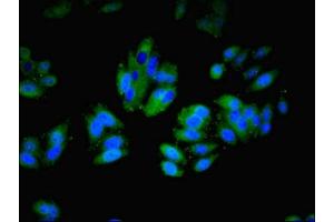 Immunofluorescent analysis of HepG2 cells using ABIN7156460 at dilution of 1:100 and Alexa Fluor 488-congugated AffiniPure Goat Anti-Rabbit IgG(H+L)