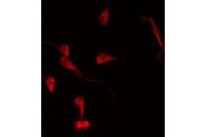 ABIN6269085 staining MDA-MB-231 by IF/ICC. (ErbB2/Her2 抗体  (C-Term))