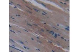 IHC-P analysis of Kidney tissue, with DAB staining. (METRN 抗体  (AA 22-291))
