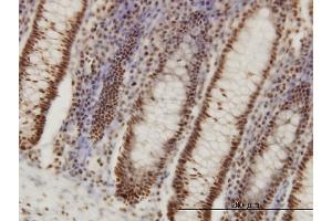 Immunoperoxidase of monoclonal antibody to PPIG on formalin-fixed paraffin-embedded human colon. (PPIG 抗体  (AA 13-106))