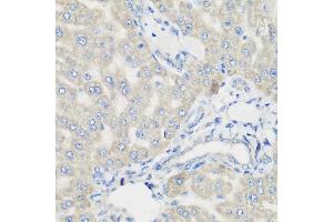 Immunohistochemistry of paraffin-embedded rat liver using PYCR1 antibody at dilution of 1:200 (40x lens). (PYCR1 抗体)
