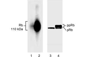 Western Blotting (WB) image for anti-Retinoblastoma 1 (RB1) (AA 514-610), (underphosphorylated) antibody (ABIN967418) (Retinoblastoma 1 抗体  (underphosphorylated))