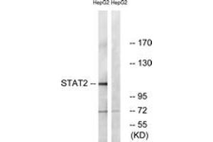 Western blot analysis of extracts from HepG2, using STAT2 (Ab-690) Antibody. (STAT2 抗体  (AA 656-705))
