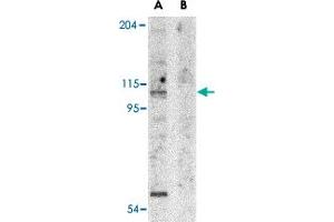 Western blot analysis of APAF1 in K-562 cell lysate with APAF1 polyclonal antibody  at 1 ug/mL in the (A) absence and (B) presence of blocking peptide. (APAF1 抗体  (N-Term))