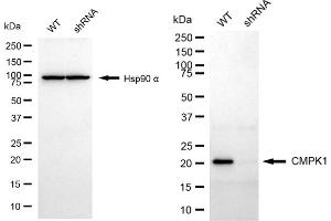 anti-Cytidine Monophosphate (UMP-CMP) Kinase 1, Cytosolic (CMPK1) antibody