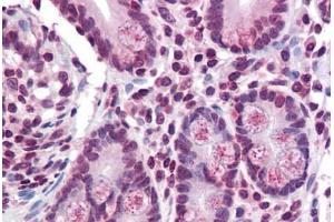 Small intestine, Human: Formalin-Fixed, Paraffin-Embedded (FFPE) (TMPRSS4 抗体  (Internal Region))