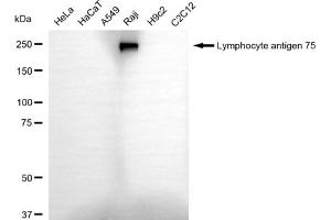 anti-Lymphocyte Antigen 75 (LY75) antibody