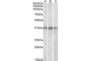 ABIN1686788 (1µg/ml) staining of Daudi,(A) Jurkat (B) and Jurkat nuclear (C) lysates (35µg protein in RIPA buffer). (PHF11 抗体  (Internal Region))