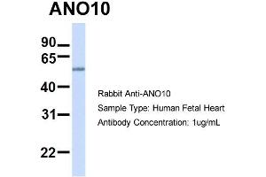 Host:  Rabbit  Target Name:  ANO10  Sample Type:  Human Fetal Heart  Antibody Dilution:  1. (Anoctamin 10 抗体  (C-Term))