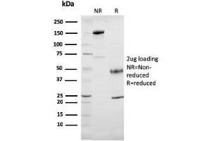 SDS-PAGE Analysis Purified Cytochrome C Mouse Monoclonal Antibody (7H8. (Cytochrome C 抗体  (AA 1-80))