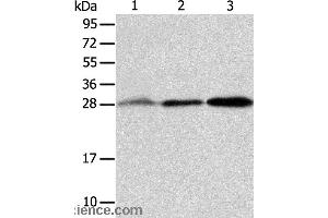 Western blot analysis of Human fetal liver and seminoma tissue, RAW264. (ALKBH2 抗体)