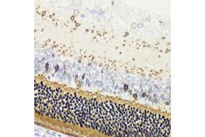 Immunohistochemistry of paraffin-embedded rat retina using RCVRN antibody (ABIN6128676, ABIN6146832, ABIN6146833 and ABIN6222036) at dilution of 1:200 (40x lens). (Recoverin 抗体  (AA 1-200))