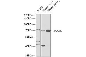 Western blot analysis of extracts of various cell lines, using SOCS6 antibody (ABIN6128785, ABIN6148273, ABIN6148274 and ABIN6225294) at 1:1000 dilution. (SOCS6 抗体  (AA 1-210))