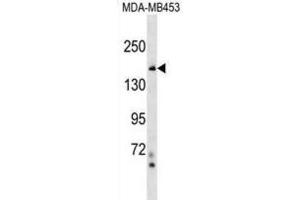 Western Blotting (WB) image for anti-Tonsoku-Like, DNA Repair Protein (NFKBIL2) antibody (ABIN2999689) (NFKBIL2 抗体)