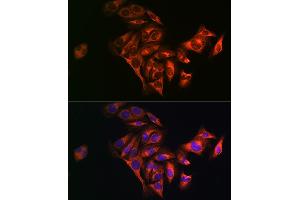 Immunofluorescence analysis of U2OS cells using Fatty Acid Synthase (FASN) Rabbit pAb (ABIN3020990, ABIN3020991, ABIN3020992 and ABIN6213855) at dilution of 1:100 (40x lens). (Fatty Acid Synthase 抗体  (AA 2212-2511))