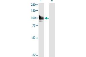 Western Blotting (WB) image for anti-Signal Transducer and Activator of Transcription 6, Interleukin-4 Induced (STAT6) (AA 694-801) antibody (ABIN563038)