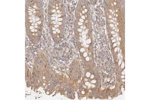 Immunohistochemical staining of human appendix with KCMF1 polyclonal antibody  shows moderate cytoplasmic positivity in glandular cells at 1:200-1:500 dilution. (KCMF1 抗体)
