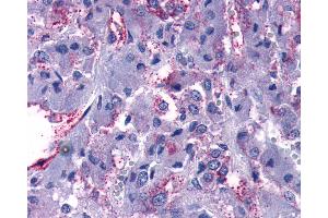 Anti-GPR108 antibody IHC of human adrenal. (GPR108 抗体  (Cytoplasmic Domain))