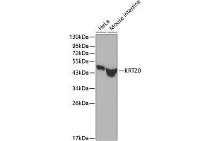 Western blot analysis of extracts of various cell lines using KRT20 Polyclonal Antibody. (KRT20 抗体)