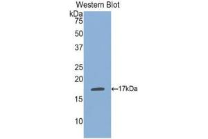 Western blot analysis of the recombinant protein. (PLA1A 抗体  (AA 148-295))