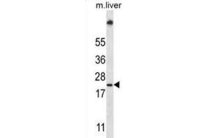 Western Blotting (WB) image for anti-Ubiquitin-Conjugating Enzyme E2W (UBE2W) antibody (ABIN2997430) (UBE2W 抗体)