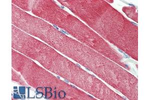 Immunohistochemistry (IHC) image for anti-DnaJ (Hsp40) Homolog, Subfamily C, Member 5 (DNAJC5) (AA 177-191) antibody (ABIN5539515)