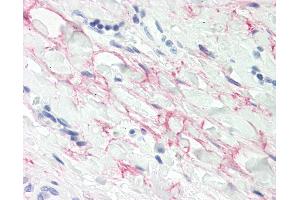 Anti-MFAP4 antibody IHC staining of human tonsil, collagenous stroma. (MFAP4 抗体  (AA 228-255))