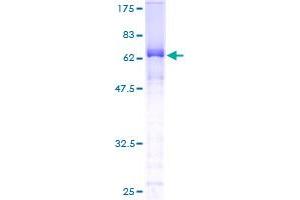 Image no. 1 for Stem-Loop Binding Protein (SLBP) (AA 1-270) protein (GST tag) (ABIN1320112) (SLBP Protein (AA 1-270) (GST tag))