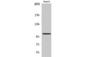 Western Blotting (WB) image for anti-Nuclear Factor of kappa Light Polypeptide Gene Enhancer in B-Cells 1 (NFKB1) (Thr145) antibody (ABIN6285220)