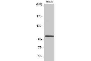 Western Blotting (WB) image for anti-Nuclear Factor of kappa Light Polypeptide Gene Enhancer in B-Cells 1 (NFKB1) (Thr145) antibody (ABIN3180205) (NFKB1 抗体  (Thr145))