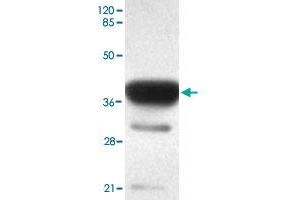 Western blot analysis of ACSS1 monoclonal antibody  at 1 : 2000 dilution interacts with recombinant ACSS1 protein with a GST tag. (ACSS1 抗体  (C-Term))