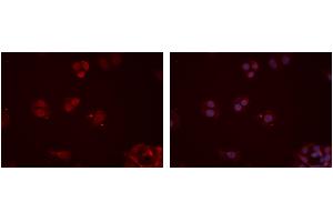 ABIN6277354 staining Hela cells by IF/ICC. (CX3CR1 抗体  (N-Term))