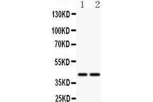 Anti- CD244 antibody, Western blotting All lanes: Anti CD244  at 0. (2B4 抗体  (C-Term))