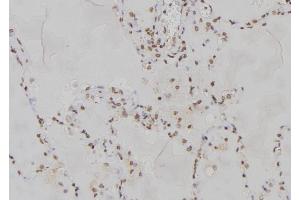 ABIN6277167 at 1/100 staining Human lung tissue by IHC-P. (PPP2R2A 抗体  (Internal Region))