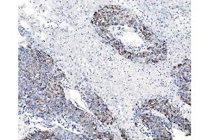 IHC analysis of CHCHD10 using anti-CHCHD10 antibody (ABIN7602507). (CHCHD10 抗体  (AA 80-142))