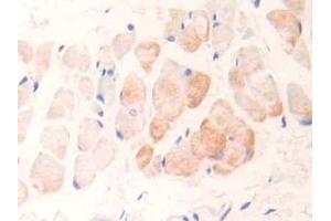Detection of cTnI in Rat Skin Tissue using Polyclonal Antibody to Cardiac Troponin I (cTnI) (TNNI3 抗体  (AA 1-211))