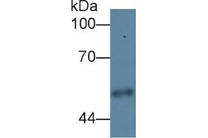 Detection of CPE in Human Urine using Polyclonal Antibody to Carboxypeptidase E (CPE) (CPE 抗体  (AA 318-476))