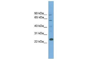 WB Suggested Anti-BCL7A Antibody Titration: 0. (BCL7A 抗体  (Middle Region))