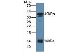 Detection of SAA2 in Mouse Serum using Polyclonal Antibody to Serum Amyloid A2 (SAA2) (SAA2 抗体  (AA 20-122))