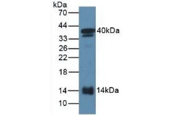 SAA2 抗体  (AA 20-122)