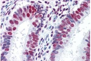Human Uterus: Formalin-Fixed, Paraffin-Embedded (FFPE) (HNRNPM 抗体  (AA 17-113))