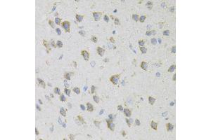 Immunohistochemistry of paraffin-embedded mouse brain using CDA Antibody (ABIN6291347) at dilution of 1:100 (40x lens). (CDA 抗体)
