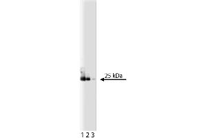 Western blot analysis of eIF-4E on a A431 lysate. (EIF4E 抗体  (AA 1-217))