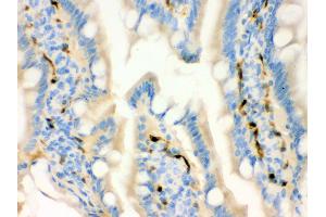 Immunohistochemistry (Paraffin-embedded Sections) (IHC (p)) image for anti-Fatty Acid Binding Protein 4, Adipocyte (FABP4) (AA 10-40), (N-Term) antibody (ABIN3043827)