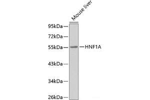 Western blot analysis of extracts of Mouse liver using HNF1A Polyclonal Antibody. (HNF1A 抗体)