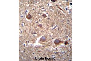 Immunohistochemistry (IHC) image for anti-Inositol-Trisphosphate 3-Kinase B (ITPKB) antibody (ABIN3003734) (ITPKB 抗体)