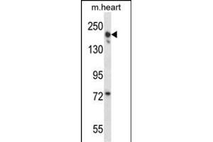 LRRC16B Antibody (C-term) (ABIN657937 and ABIN2846881) western blot analysis in mouse heart tissue lysates (35 μg/lane). (LRRC16B 抗体  (C-Term))