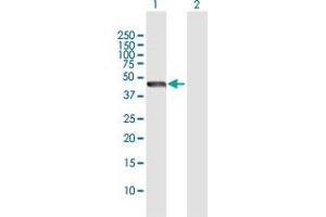 Western Blot analysis of STOML2 expression in transfected 293T cell line by STOML2 MaxPab polyclonal antibody. (STOML2 抗体  (AA 1-356))