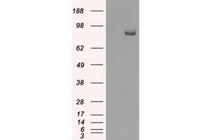HEK293T cells were transfected with the pCMV6-ENTRY control (Left lane) or pCMV6-ENTRY SATB1 (Right lane) cDNA for 48 hrs and lysed. (SATB1 抗体)