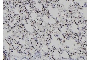 ABIN6277939 at 1/100 staining Rat lung tissue by IHC-P. (T-Bet 抗体  (Internal Region))